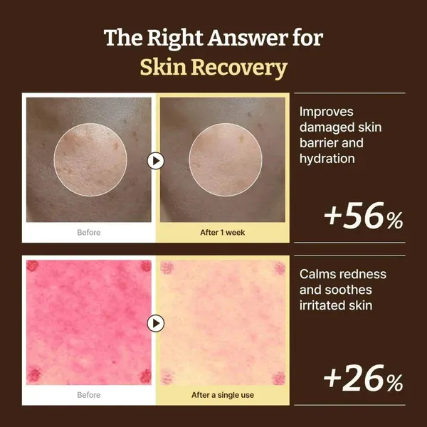 Advanced-PDRN-Rejuvenating-Cream-DR_REJU-ALL-4.webp