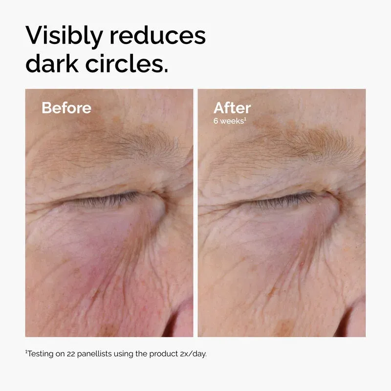 caffeine eye care 1.webp
