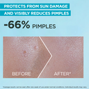 BEFOREANDAFTEROFGarnierFastClearGentleCleanserHydratingFaceWashforAcneProneSkin250ml.png